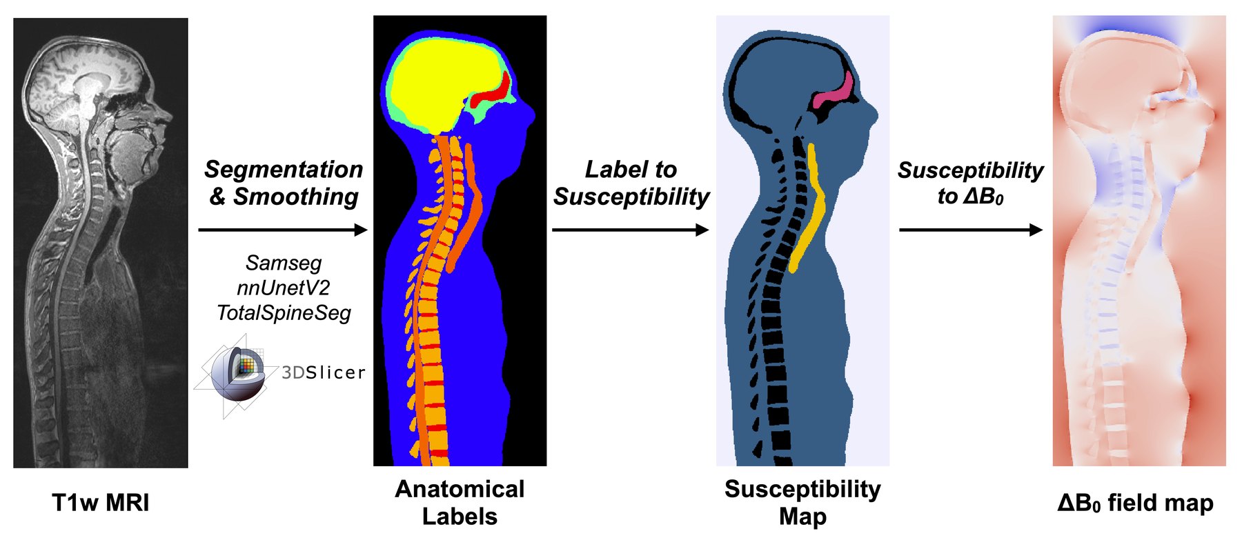 Four-stage pipeline. A sagittal T1-weighted MRI of the head and
                      torso is segmented into coloured anatomical labels covering skull,
                      brain, vertebrae and soft tissue; the labels are converted to a
                      susceptibility map; the susceptibility map is converted to a delta
                      B-zero field map shown in red and blue.