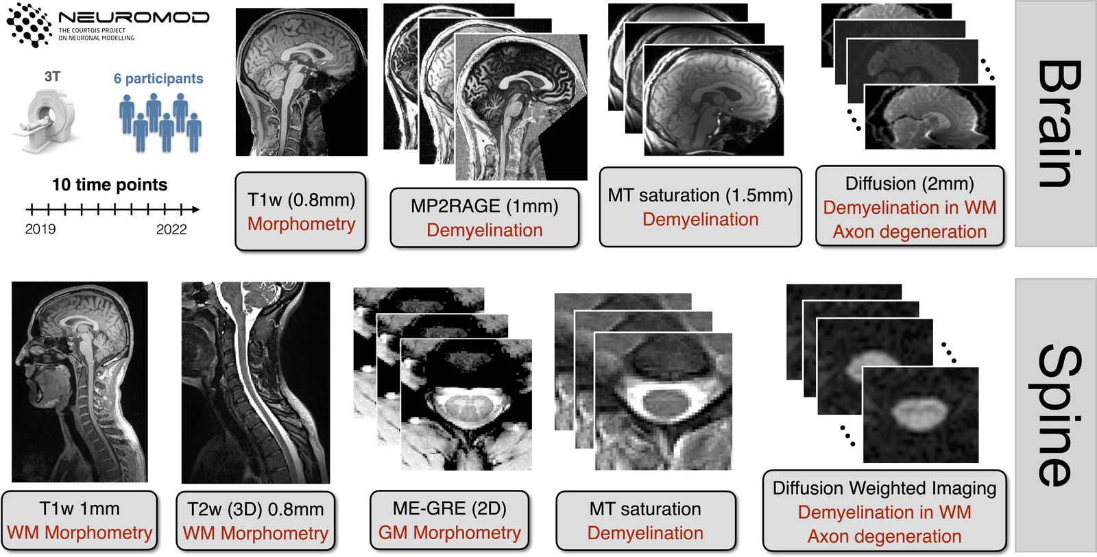 Study design: six participants scanned at ten time points on a
                      3T scanner between 2019 and 2022. Brain acquisitions include
                      T1-weighted, MP2RAGE, MT saturation and diffusion; spine
                      acquisitions include T1-weighted, T2-weighted, multi-echo
                      gradient echo, MT saturation and diffusion-weighted imaging.